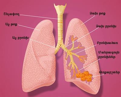 imgpsh_fullsize (2).jpg