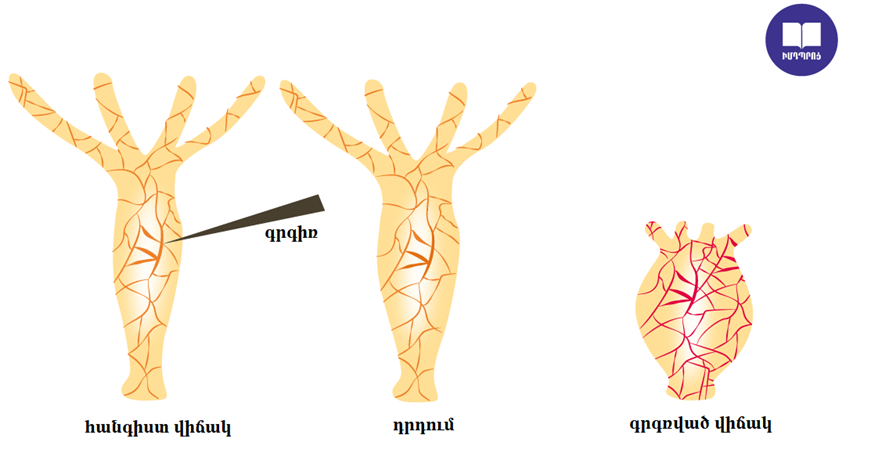 հիդրա.png